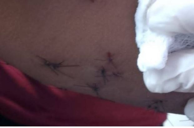 Victima de agresión